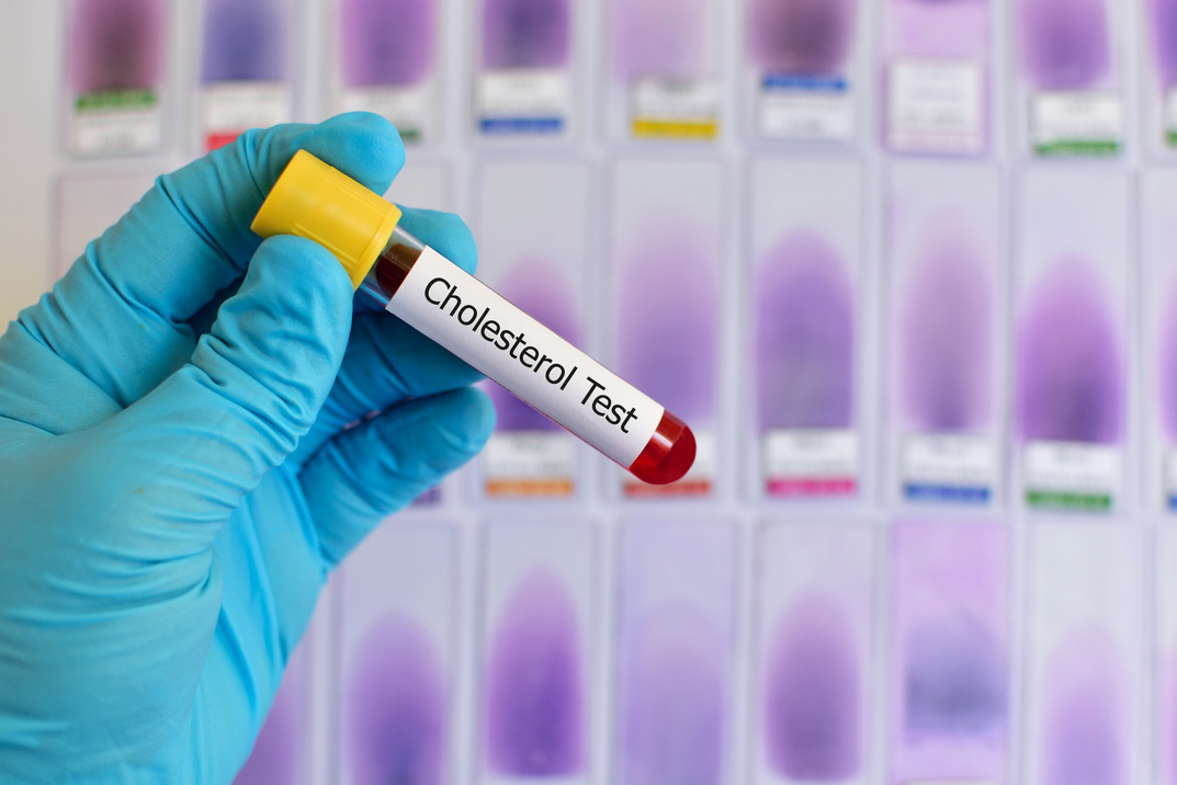 Cholesterol testing